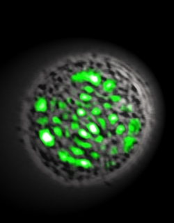 Żywa komórka źródłem światła laserowego